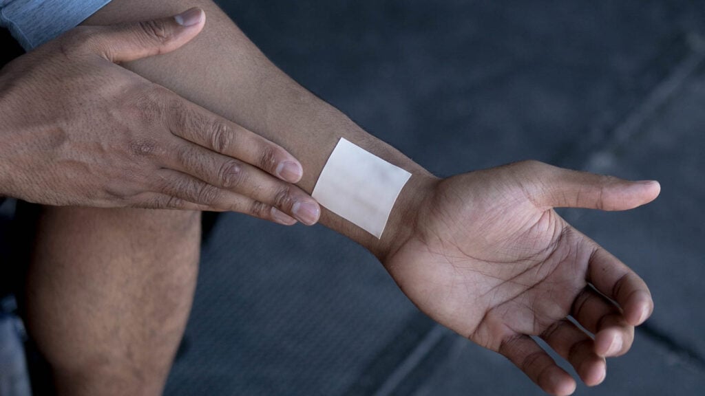 Transdermal Patches A Controlled Systemic Delivery Method